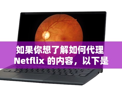 如果你想了解如何代理 Netflix 的内容，以下是一些可能的解释和建议
